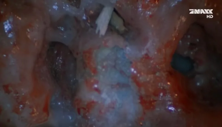 Момент из 2 серии 6 сезона